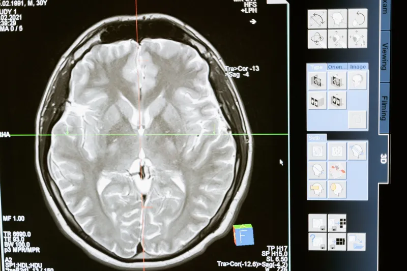 Two Languages, One Sharper Mind: The Neuroscience Behind Bilingual Cognitive Advantage